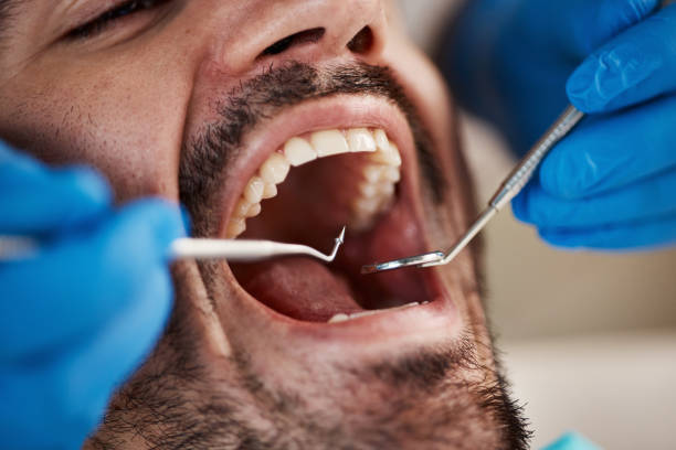 Best Mobile Emergency Dentist in Miami, OK